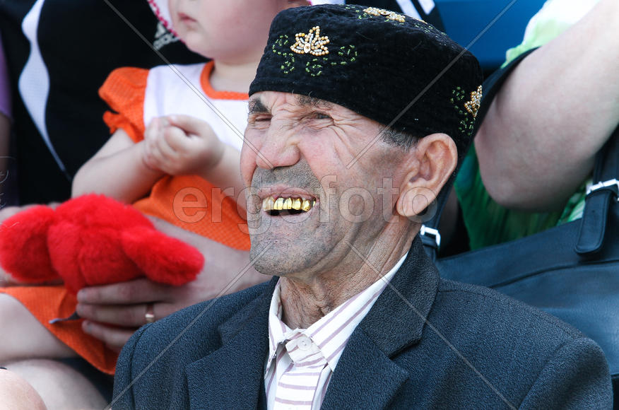 "Золотая улыбка"