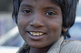 Boy face beggars in the Pakistani city of Karachi